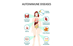 Die Autoimmundiagnostik-Palette von Szabo-Scandic