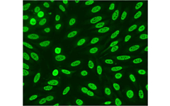 Neues Produkt im Bereich Autoimmundiagnostik von unserem Partner Immco: