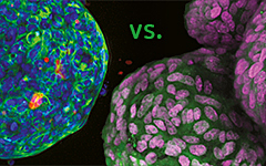 spheroid vs. organoid