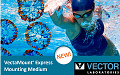 VectaMount Express neu von Vector