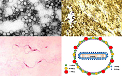 rare diseases