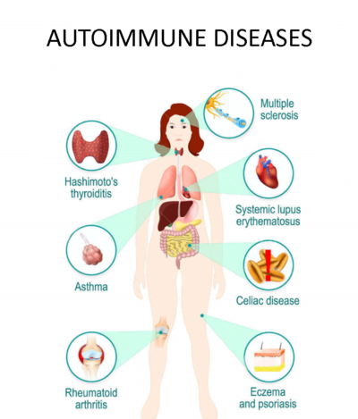 Autoimmunerkrankung Übersicht