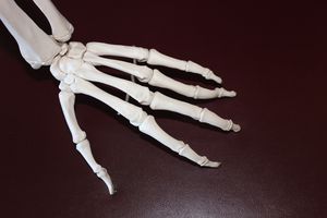 Rheumatoide Arthritis