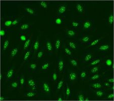 HEp-2 ELITE DFS70 KO Centromere