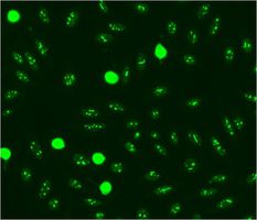 HEp-2 ELITE DFS70 KO Nucleolar