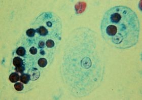 Entamoeba histolytica