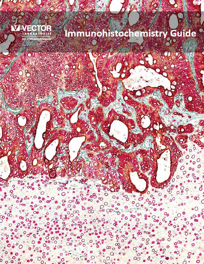 IHC Guide