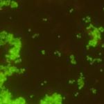MRSA