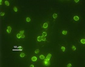 CRYPTOSPORIDIUM PARVUM
