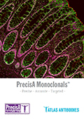 Atlas Antibodies PrecisA Monoclonals